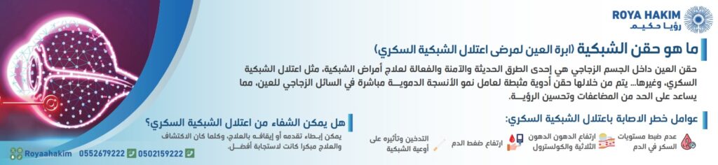 حقن الشبكية