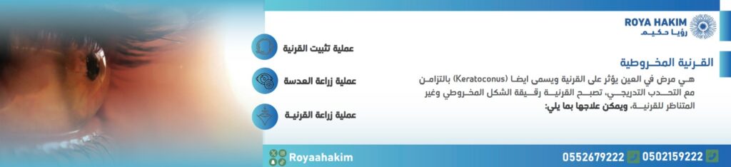 القرنية المخروطية