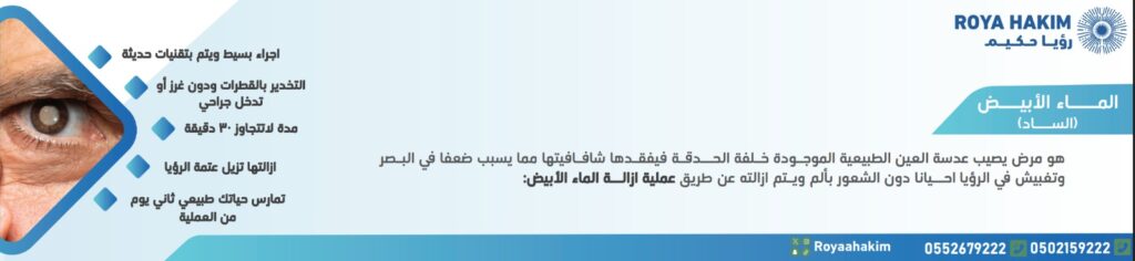 الماء الأبيض